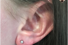 Ear lobe with NeoMetal. Inkhaus Tattoo.