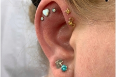 HEALED Double Forward Helix w/ BVLA.