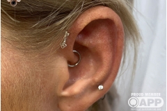 Forward Helix w/ BVLA.
