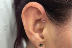 Forward Helix w/ NeoMetal.
