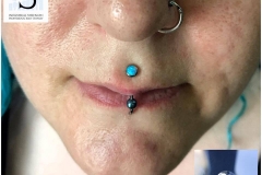 Healed Medusa with Industrial Strength. Inkhaus Tattoo.